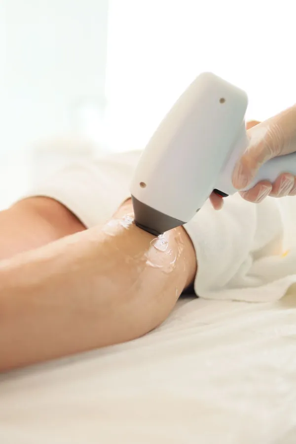 Epilazione laser professionale